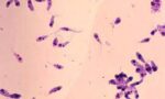 Köpeklerde Leishmania Hastalığı | VetBilgi